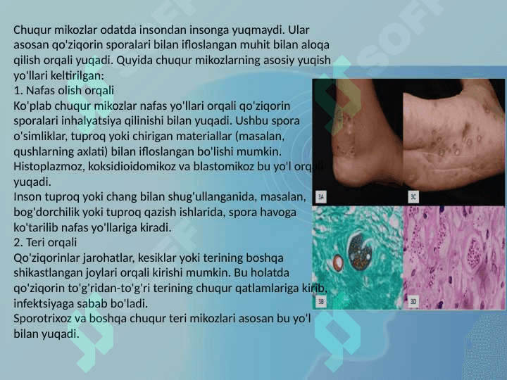 Chuqur mikozlar ppt 3