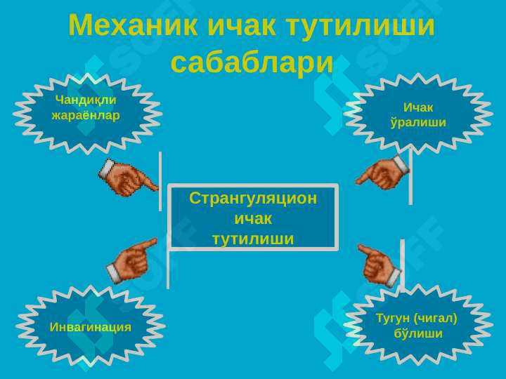 O'tkir ichak tutulishi ppt 8