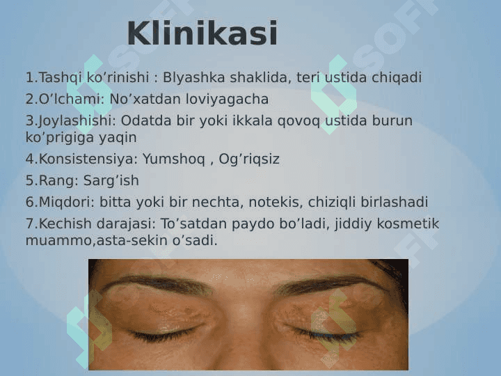 Gidrona va lipoma ppt 4