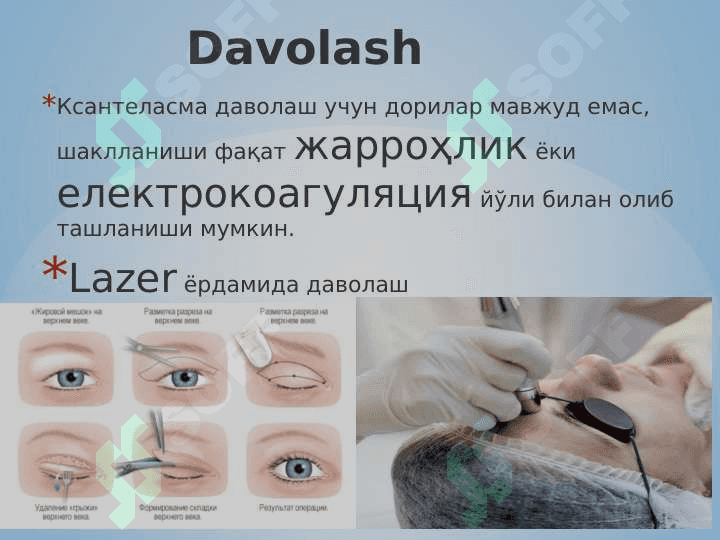 Gidrona va lipoma ppt 6