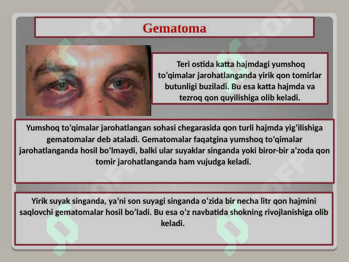 Shikastlanishlar toʻgʻrisida umumiy malumot 3