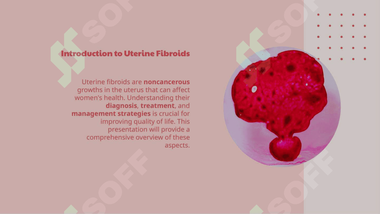 Uterine fibroids 3