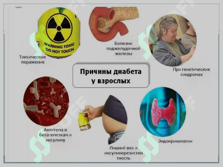Qandli diabet 5