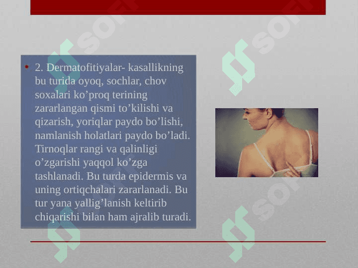 Zamburugli kasaliklarning oziga xosligi 5
