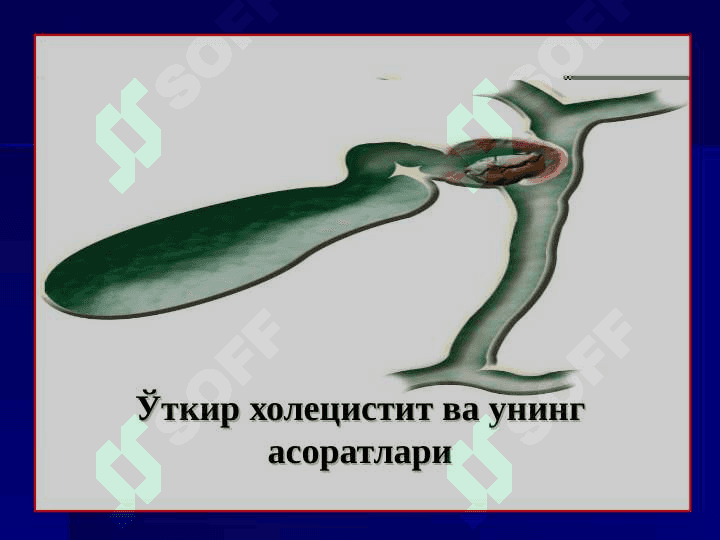 O`TKIR XOLESISTIT ASORATLARI 2