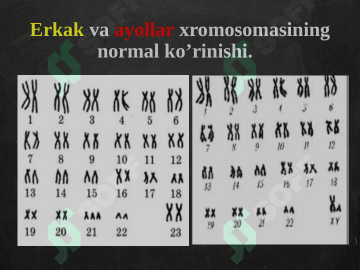 Odamda uchraydigan irsiy kasalliklar 5