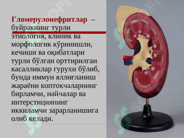 Bolalarda glomerulonefritlar . БОЛАЛАРДА ГЛОМЕРУЛОНЕФРИТЛАР . GLOMERULONEPHRITIS AT CHILDREN 7