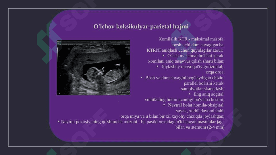 Ultratovush tadqiqot homiladorlikning birinchi trimestrida 8