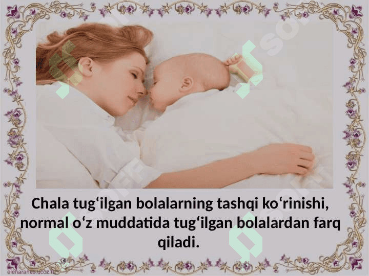 Chala tug‘ilgan bolalar — fiziologiyasi, rivojlanishi. Muddatiga yetmay tug’ulgan chaqaloqlar, rivojlanishi  va parvarishlash 8