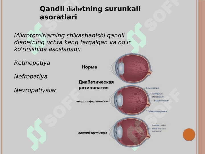 Diabetologiya.Qandli diabetning surunkali asoratlari.Makro va mikroangiopatiyalar (retinopatiya, nefropatiya, neyropatiya)      patogenezi, tashxislash, klinikasi,                 davolash prinsiplari 4