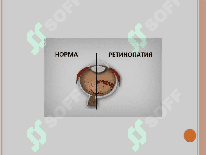 Diabetologiya.Qandli diabetning surunkali asoratlari.Makro va mikroangiopatiyalar (retinopatiya, nefropatiya, neyropatiya)      patogenezi, tashxislash, klinikasi,                 davolash prinsiplari 7