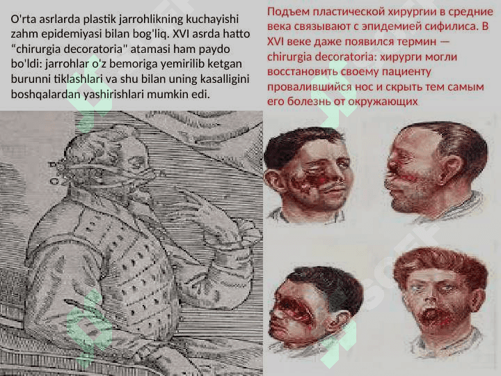 PLASTIK VA RЕKONSTRUKTIV XIRURGIYA ASOSLARI 8