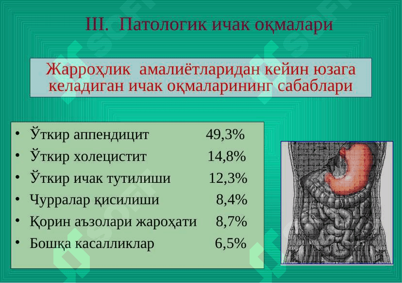 Ichak oqmalari . Ичак оқмалари 7