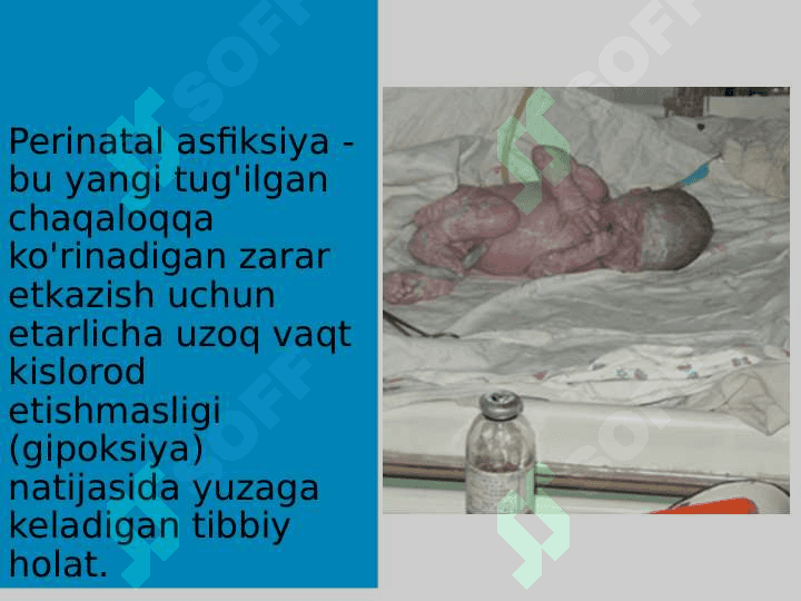 Chaqaloqlar asfiksiyasi 3