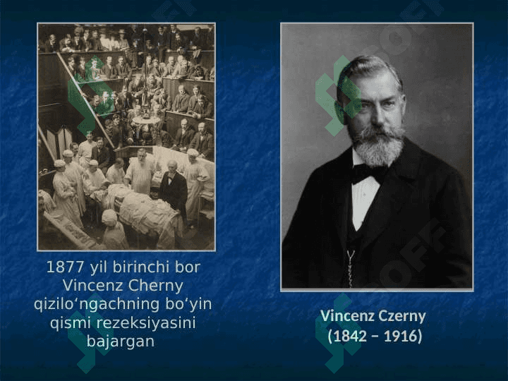 Qizilo‘ngach kasalliklari 5