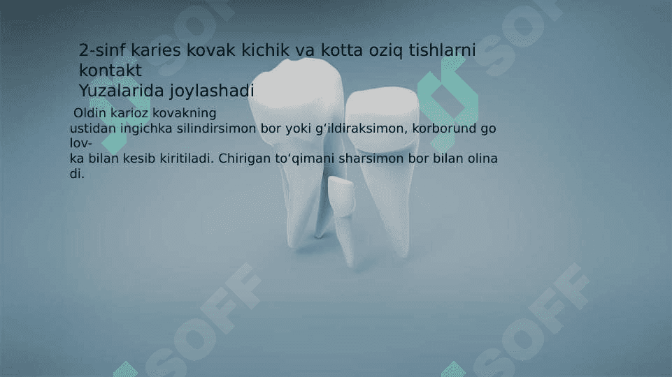 Fantomlarda. sinf karioz bo'shliqlarini charxlash va plombalash. 4