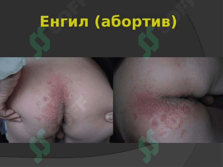 Ўраб олувчи темиратки 8