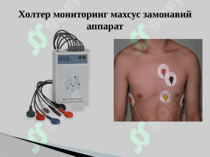 Юрак касалликларини замонавий текшириш усуллари 3