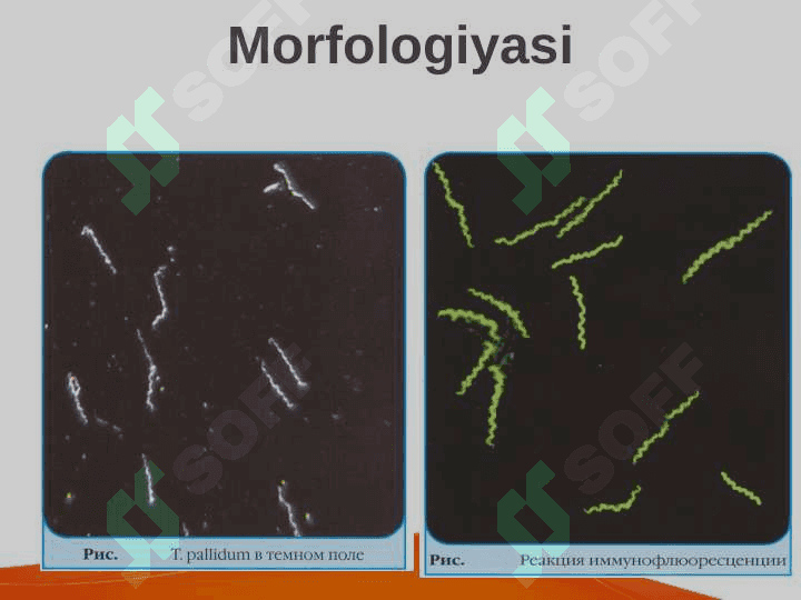 Patogen spiroxetalar.  Zaxm qoʼzgʼatuvchilari. Mikrobiologik xususiyatlari.  Rikketsiozlar. Toshmali tif qoʼzgʼatuvchilari 5