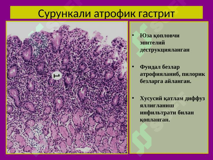 Меъда касалликлари 6