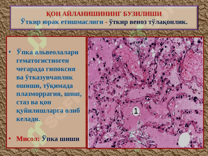 Қон айланишининг бузилиши. Артериал ва веноз тўлақонлик. Қон кетиши 6