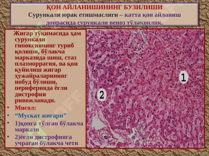Қон айланишининг бузилиши. Артериал ва веноз тўлақонлик. Қон кетиши 8