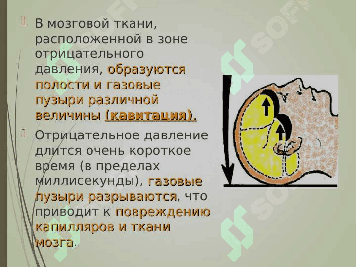 Черепно–мозговая травма 5