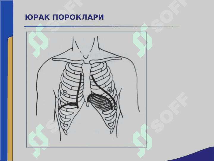 Yurak paroklari ppt 6