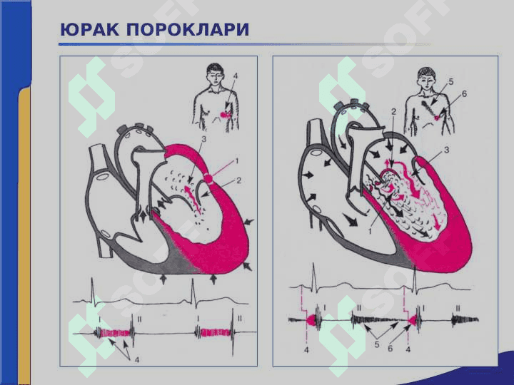 Yurak paroklari ppt 8