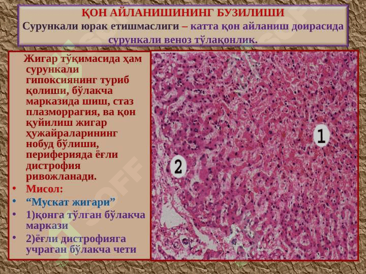 Qon aylanishi buzulishi ppt 8