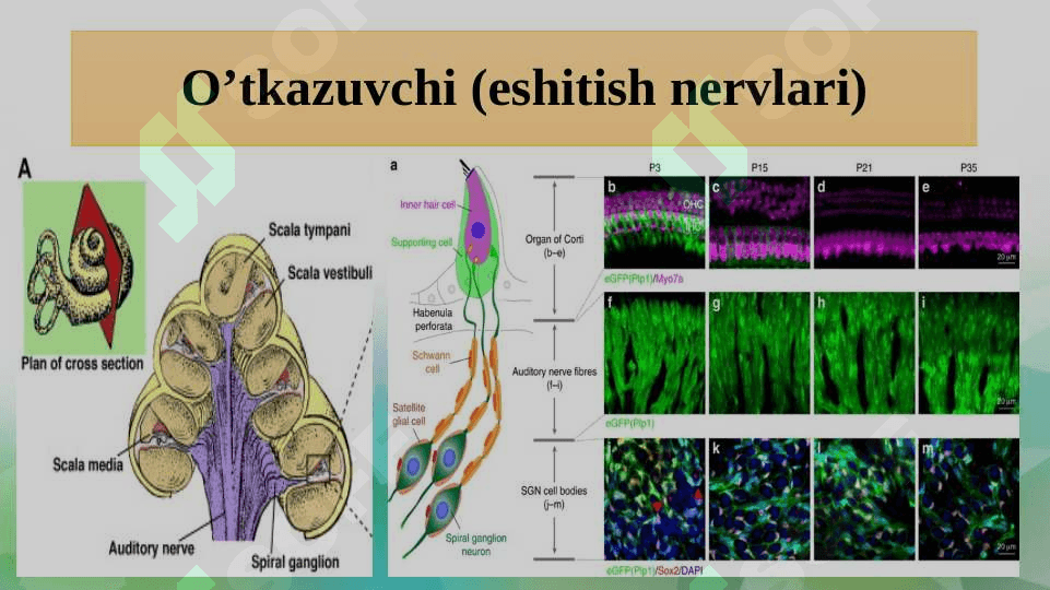 KOXLEAR IMPLANTLI BOLALAR 6