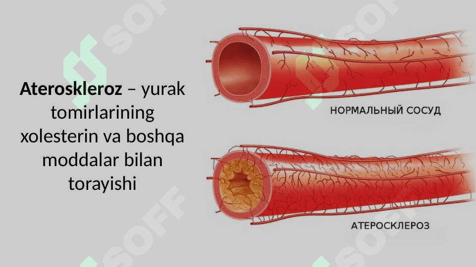 Stenokardiya 4