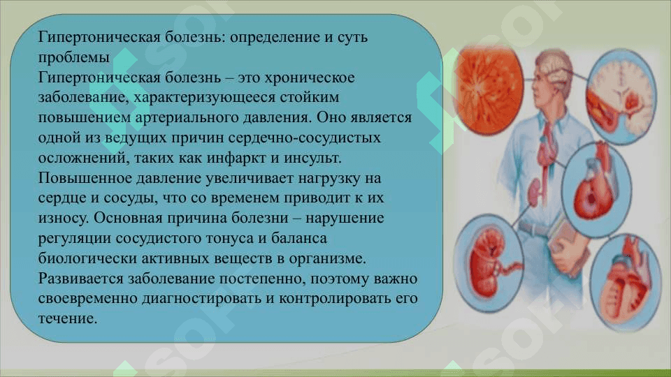 Гипертоническая болезнь и  почечная артериальная гипертензия, этиология, патогенез, классификация. 4