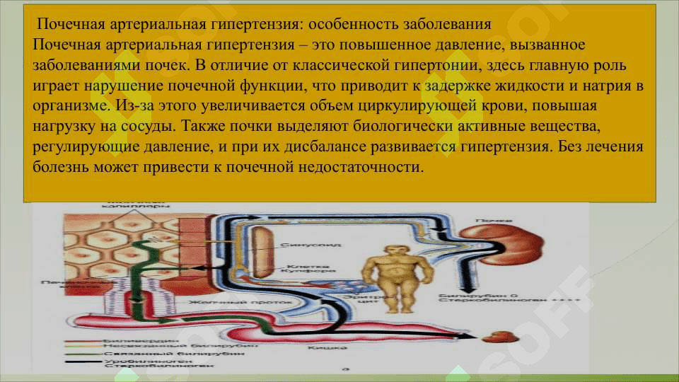 Гипертоническая болезнь и  почечная артериальная гипертензия, этиология, патогенез, классификация. 5