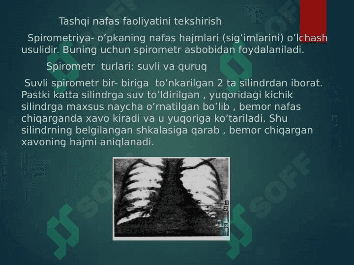 Nafas a’zolari kasalliklaridagi balg’am va plevra suyuqligini laborator tekshiruv natijalarini interpretatsiyasi 2