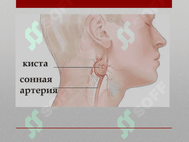 Туғма кисталар. Клиника, диагностика, даволаш. Tug`ma kistalar. Klinika, diagnostika, davolash 5
