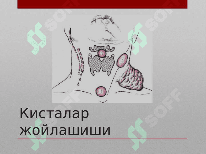 Туғма кисталар. Клиника, диагностика, даволаш. Tug`ma kistalar. Klinika, diagnostika, davolash 6