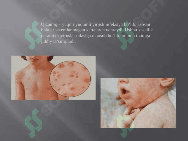 QIZAMIQ VIRUSI VA INSON ORGANIZMI 2