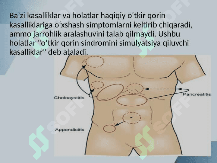 O‘tkir qorinni simulyatsiya qiladigan kasalliklar 5