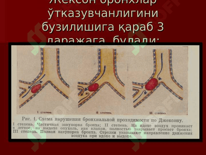 Plevra va o`pkaning havfsiz o`smalari va kistalari 7