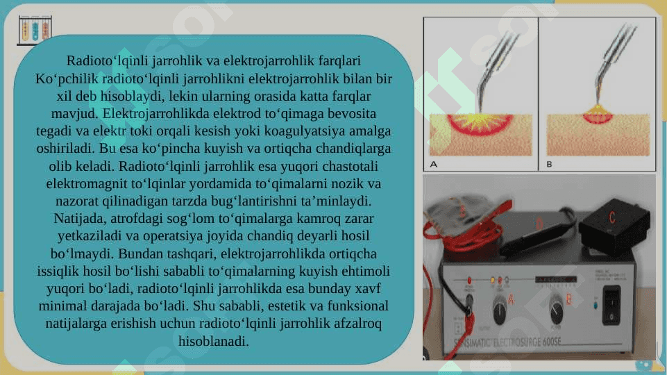 Radioto‘lqinli jarrohlik slayd 7