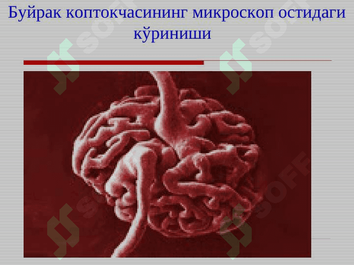 Bolalarda glomerulonefritlar . БОЛАЛАРДА ГЛОМЕРУЛОНЕФРИТЛАР 5