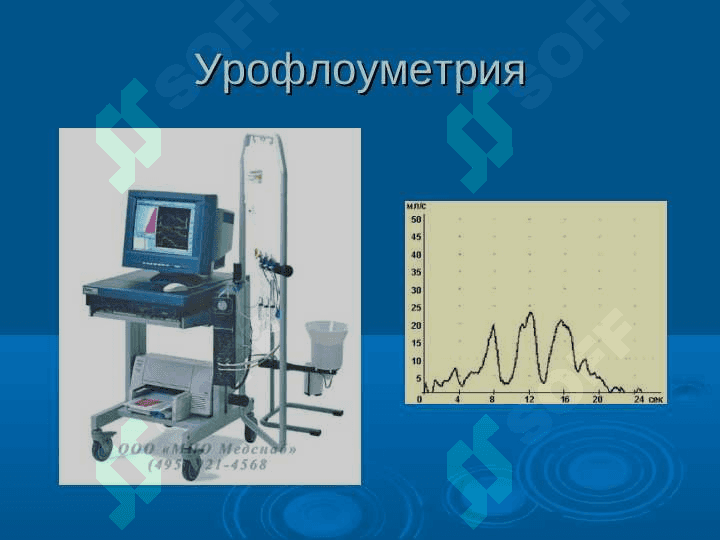 Endoskopik Urologiya. Эндоскопическая урология 5