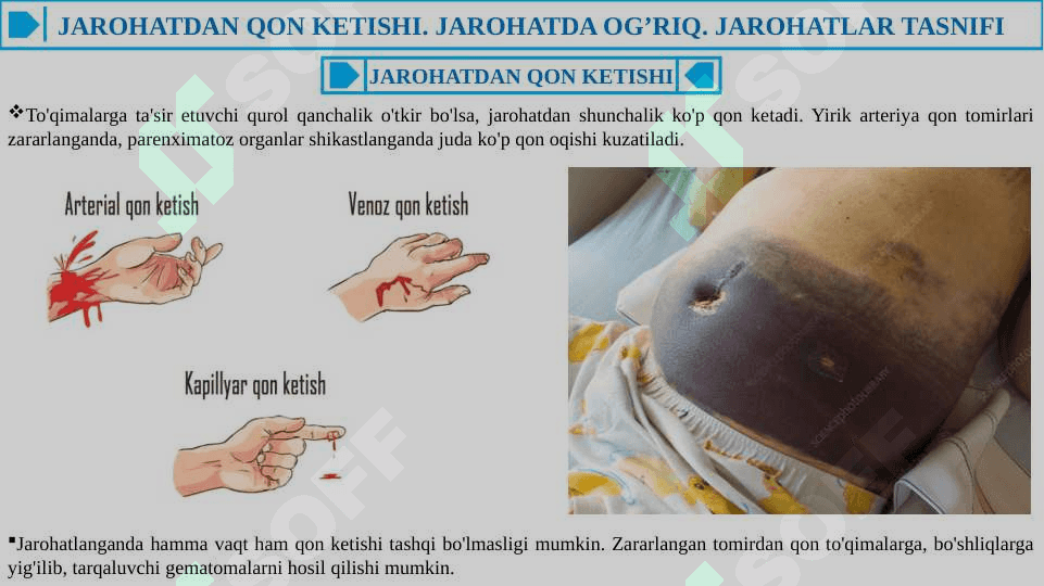 Yumshoq toʻqimalar ochiq shikasti (jarohatlar toʻgʻrisida taʼlim). Jarohatlar tasnifi. Jarohatning bitishi 4