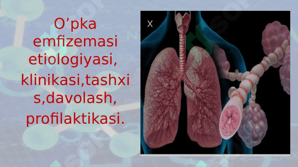 O‘pka emfizemasi 2