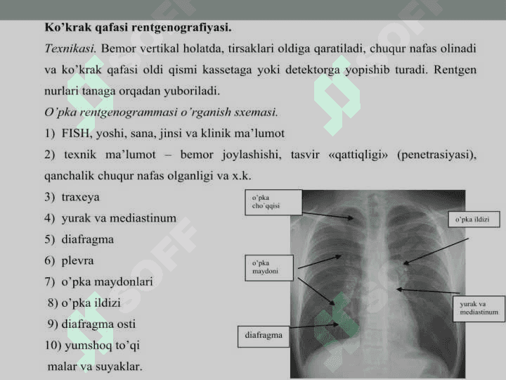 Ko'krak qafasi rentgenografiyasi.O'pka kasalliklarida nur tashxisi. 3