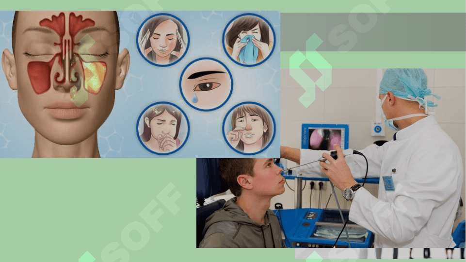Burun yondosh bo'shliqlarining klinik anatomiyasi 3