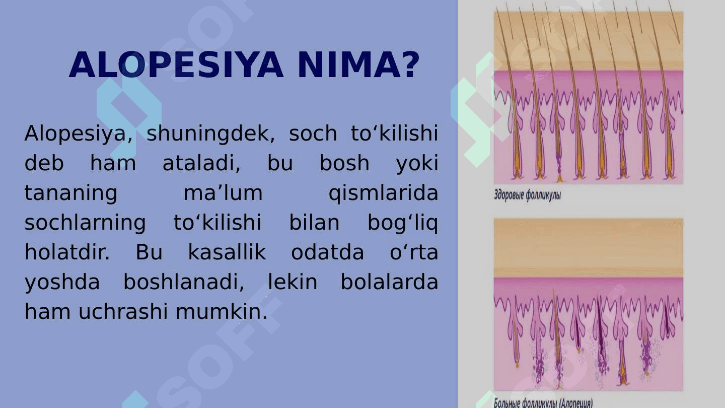 ALOPESIYANING ZAMONAVIY DAVOLASH USULLARI 3