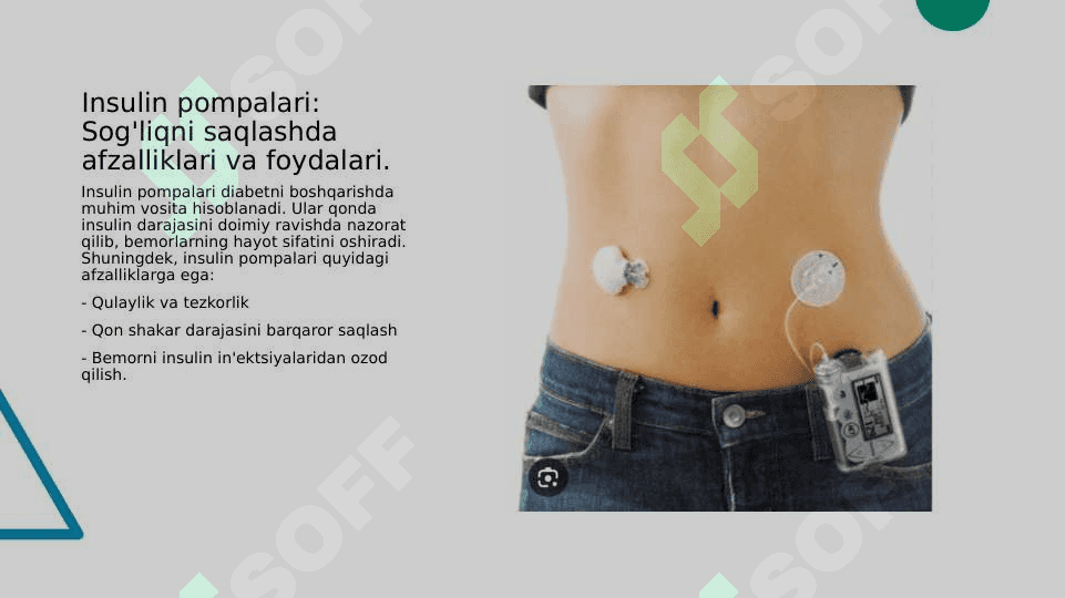 Insulin pompalari va freestyle libre 4