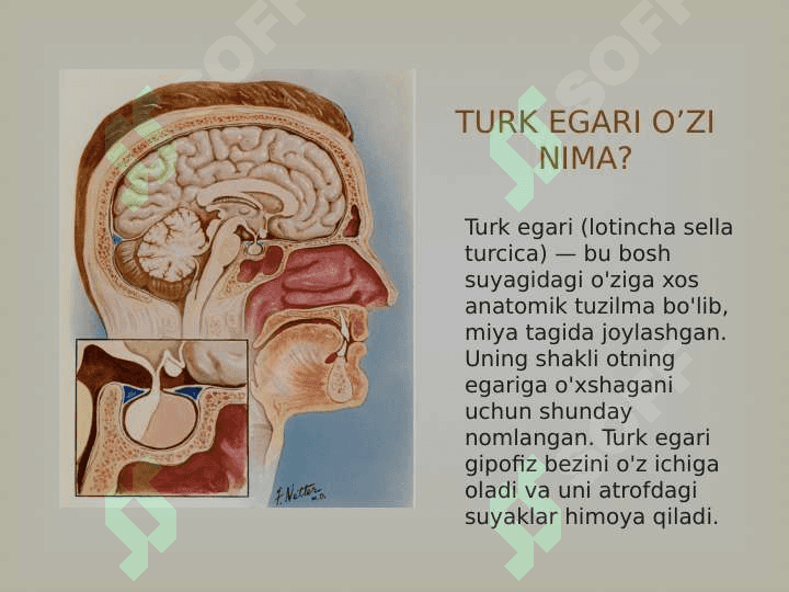Bo‘sh turk egari sindromi 3